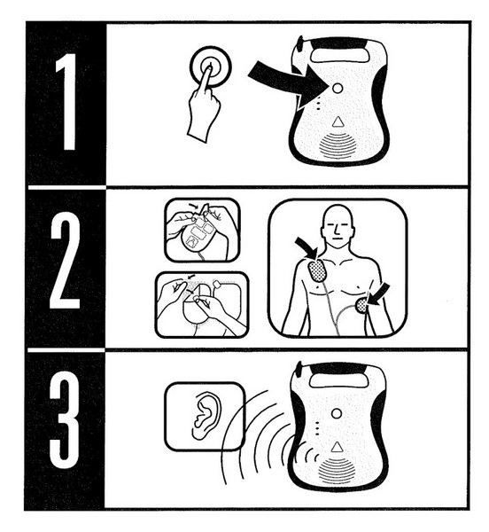 Schema zur Anwendung eines Defibrillators